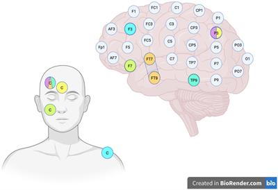 Transcranial direct current stimulation in semantic variant of primary progressive aphasia: a state-of-the-art review